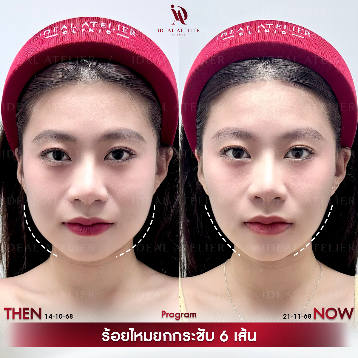 A-จีน