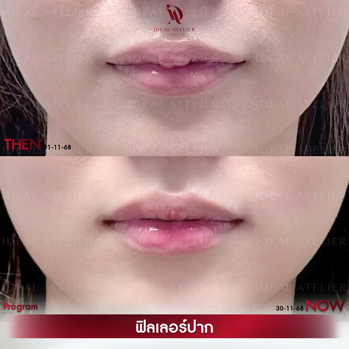 B-ครีม