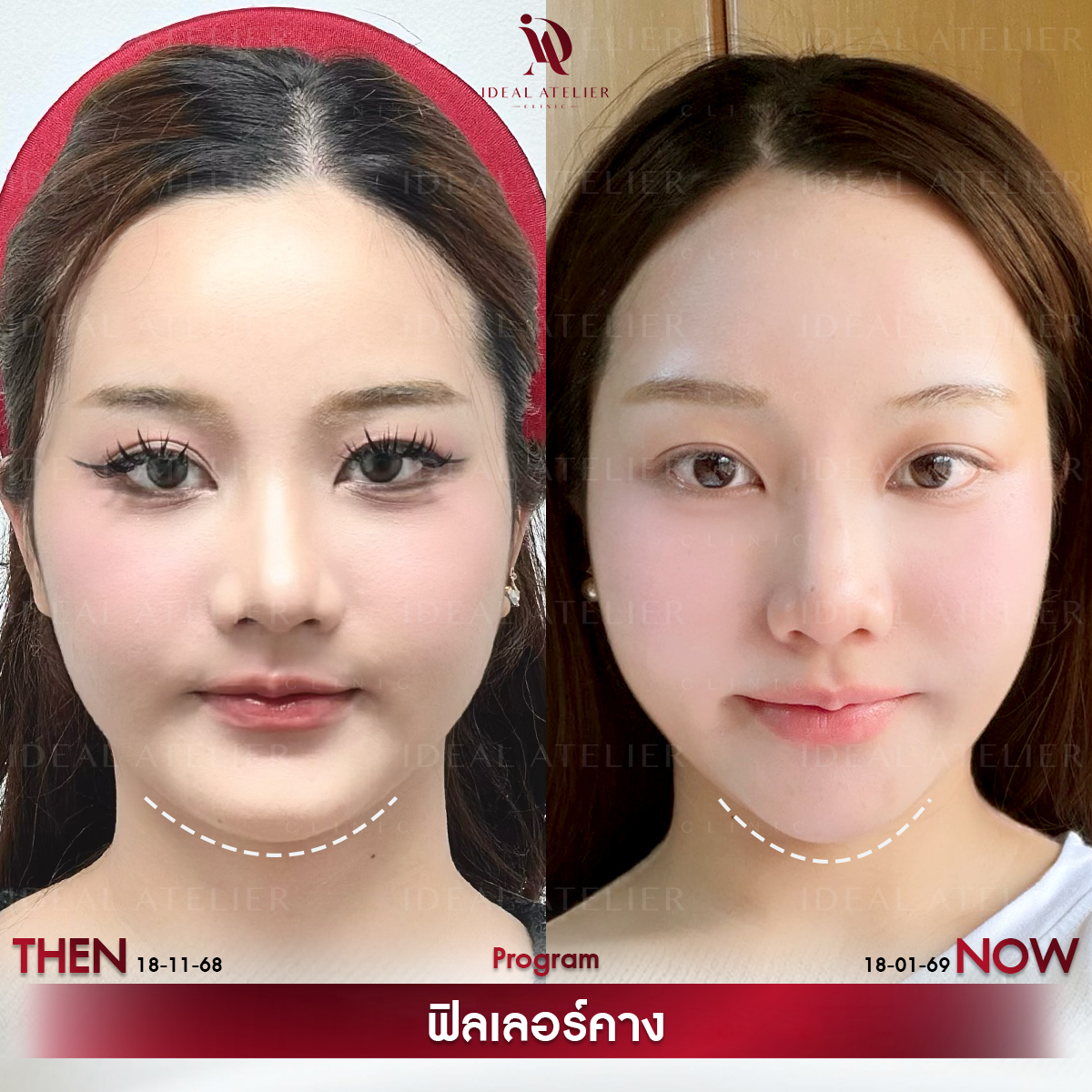 B-เค้ก