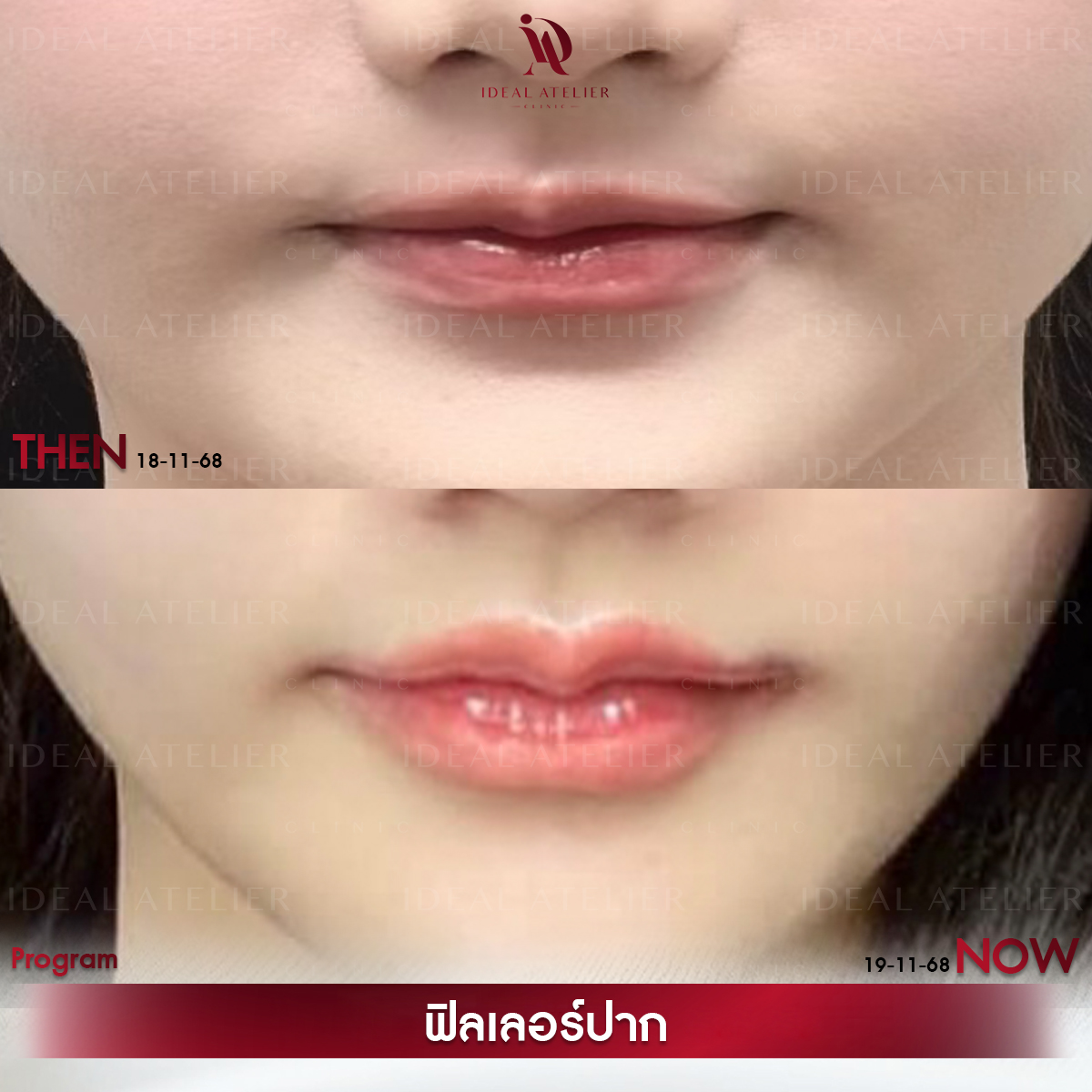 C-เค้ก