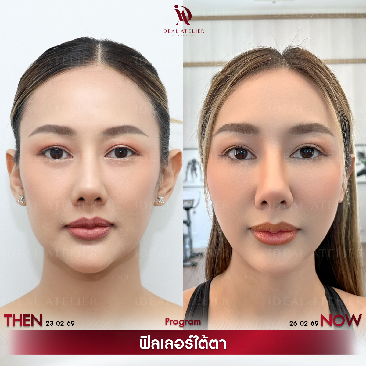 C-เรนโบว์