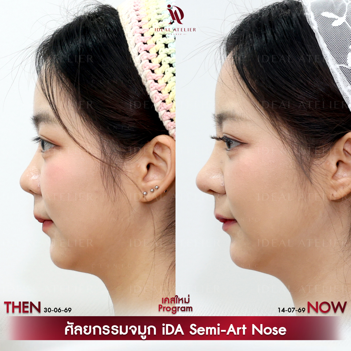 D-12-พีช