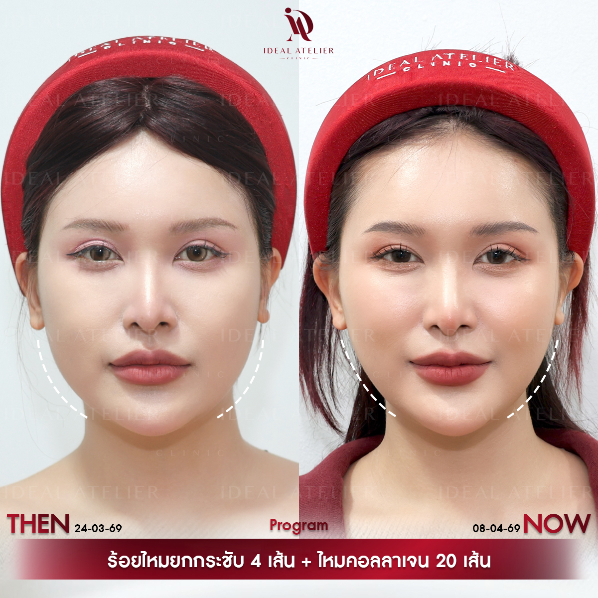 E-นิศา